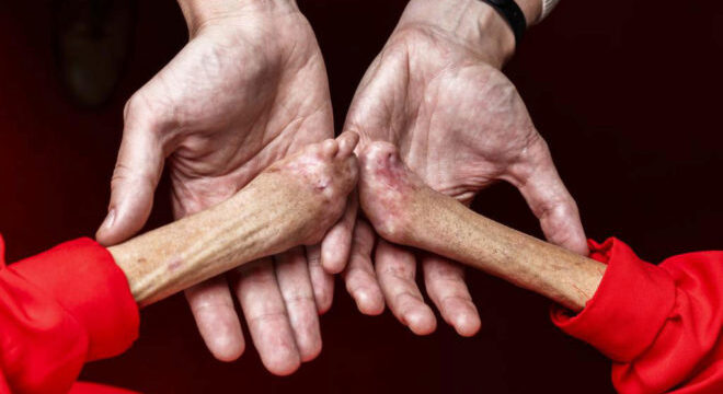 Estas manos tienen la cura para la enfermedad más cruel